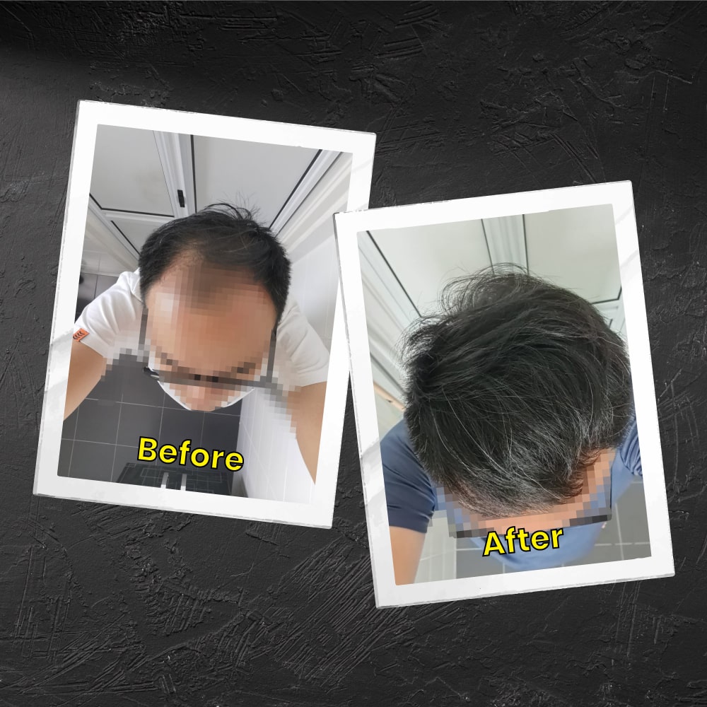 Evidence of successful hair growth treatment